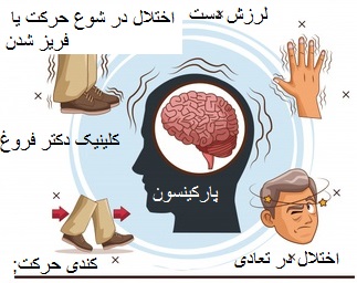 بیماری های نورولوژیک